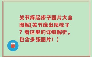 关节痒起疹子图片大全图解(关节痒出现疹子？看这里的详细解析，包含多张图片！)