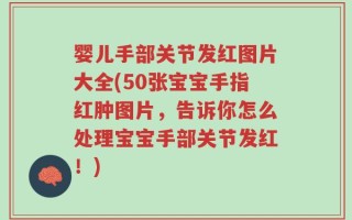 婴儿手部关节发红图片大全(50张宝宝手指红肿图片，告诉你怎么处理宝宝手部关节发红！)