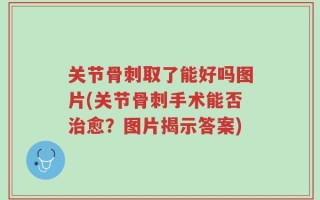 关节骨刺取了能好吗图片(关节骨刺手术能否治愈？图片揭示答案)