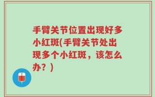 手臂关节位置出现好多小红斑(手臂关节处出现多个小红斑，该怎么办？)