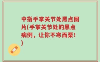 中指手掌关节处黑点图片(手掌关节处的黑点病例，让你不寒而栗！)