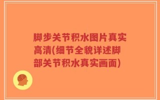 脚步关节积水图片真实高清(细节全貌详述脚部关节积水真实画面)