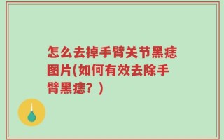 怎么去掉手臂关节黑痣图片(如何有效去除手臂黑痣？)