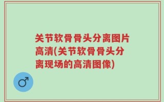 关节软骨骨头分离图片高清(关节软骨骨头分离现场的高清图像)