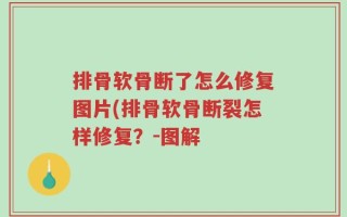 排骨软骨断了怎么修复图片(排骨软骨断裂怎样修复？-图解