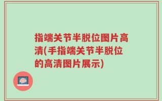 指端关节半脱位图片高清(手指端关节半脱位的高清图片展示)