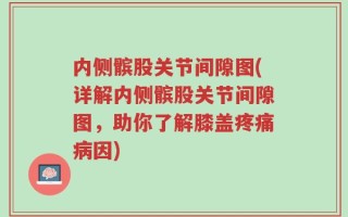 内侧髌股关节间隙图(详解内侧髌股关节间隙图，助你了解膝盖疼痛病因)