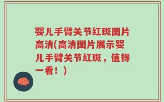婴儿手臂关节红斑图片高清(高清图片展示婴儿手臂关节红斑，值得一看！)