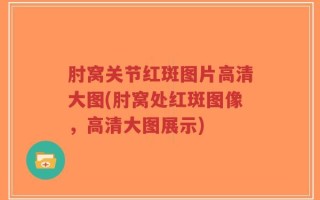 肘窝关节红斑图片高清大图(肘窝处红斑图像，高清大图展示)