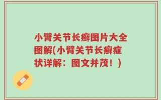 小臂关节长癣图片大全图解(小臂关节长癣症状详解：图文并茂！)