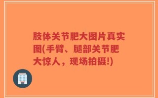 肢体关节肥大图片真实图(手臂、腿部关节肥大惊人，现场拍摄!)