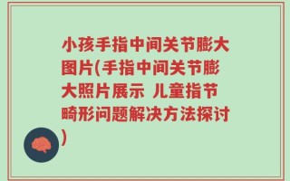 小孩手指中间关节膨大图片(手指中间关节膨大照片展示 儿童指节畸形问题解决方法探讨)