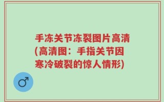 手冻关节冻裂图片高清(高清图：手指关节因寒冷破裂的惊人情形)