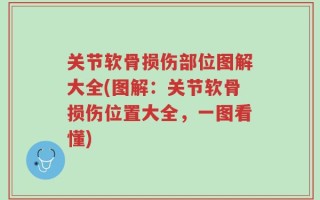 关节软骨损伤部位图解大全(图解：关节软骨损伤位置大全，一图看懂)
