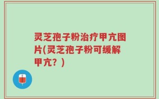 灵芝孢子粉治疗甲亢图片(灵芝孢子粉可缓解甲亢？)