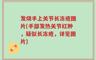 发烧手上关节长冻疮图片(手部发热关节红肿，疑似长冻疮，详见图片)