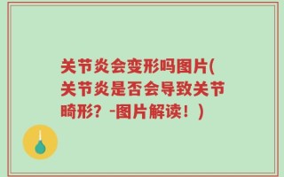 关节炎会变形吗图片(关节炎是否会导致关节畸形？-图片解读！)