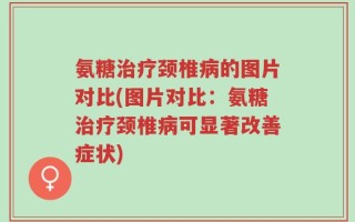 氨糖治疗颈椎病的图片对比(图片对比：氨糖治疗颈椎病可显著改善症状)
