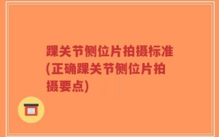 踝关节侧位片拍摄标准(正确踝关节侧位片拍摄要点)