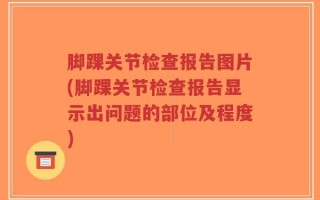 脚踝关节检查报告图片(脚踝关节检查报告显示出问题的部位及程度)