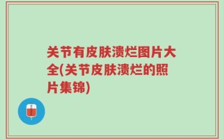 关节有皮肤溃烂图片大全(关节皮肤溃烂的照片集锦)