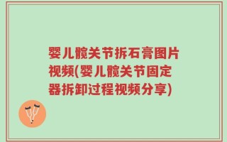 婴儿髋关节拆石膏图片视频(婴儿髋关节固定器拆卸过程视频分享)
