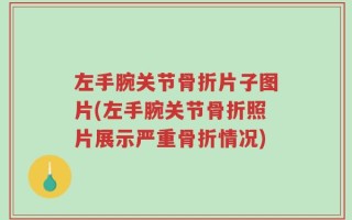 左手腕关节骨折片子图片(左手腕关节骨折照片展示严重骨折情况)