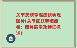关节皮肤挛缩症状表现图片(关节皮肤挛缩症状：图片展示及特征概述)