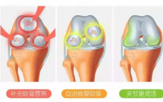 氨糖软骨素如何选？什么样的氨糖好？
