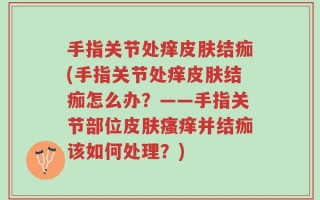 手指关节处痒皮肤结痂(手指关节处痒皮肤结痂怎么办？——手指关节部位皮肤瘙痒并结痂该如何处理？)