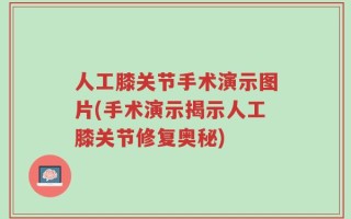 人工膝关节手术演示图片(手术演示揭示人工膝关节修复奥秘)