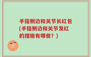 手指侧边和关节长红包(手指侧边和关节发红的措施有哪些？)