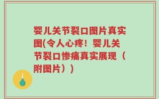 婴儿关节裂口图片真实图(令人心疼！婴儿关节裂口惨痛真实展现（附图片）)