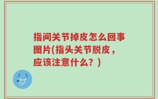 指间关节掉皮怎么回事图片(指头关节脱皮，应该注意什么？)