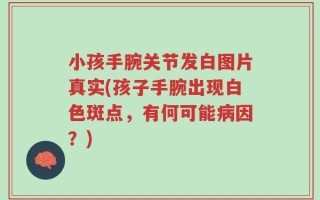 小孩手腕关节发白图片真实(孩子手腕出现白色斑点，有何可能病因？)