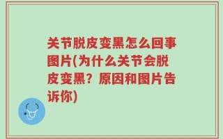 关节脱皮变黑怎么回事图片(为什么关节会脱皮变黑？原因和图片告诉你)