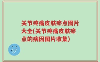 关节疼痛皮肤瘀点图片大全(关节疼痛皮肤瘀点的病因图片收集)
