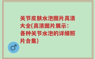关节皮肤水泡图片高清大全(高清图片展示：各种关节水泡的详细照片合集)