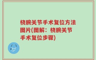 桡腕关节手术复位方法图片(图解：桡腕关节手术复位步骤)