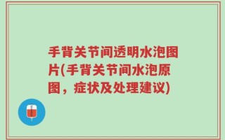 手背关节间透明水泡图片(手背关节间水泡原图，症状及处理建议)