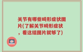 关节有哪些畸形症状图片(了解关节畸形症状，看这组图片就够了)