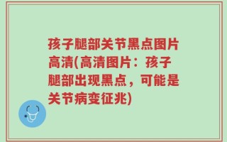 孩子腿部关节黑点图片高清(高清图片：孩子腿部出现黑点，可能是关节病变征兆)