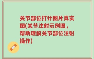 关节部位打针图片真实图(关节注射示例图，帮助理解关节部位注射操作)