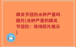 踝关节扭伤水肿严重吗图片(水肿严重的踝关节扭伤：现场照片展示)