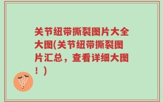 关节纽带撕裂图片大全大图(关节纽带撕裂图片汇总，查看详细大图！)