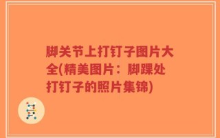脚关节上打钉子图片大全(精美图片：脚踝处打钉子的照片集锦)