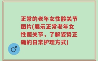 正常的老年女性髋关节图片(展示正常老年女性髋关节，了解姿势正确的日常护理方式)