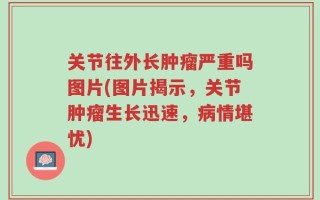 关节往外长肿瘤严重吗图片(图片揭示，关节肿瘤生长迅速，病情堪忧)
