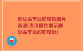 脚趾关节处筋膜炎图片高清(高清图片展示脚趾关节处的筋膜炎)
