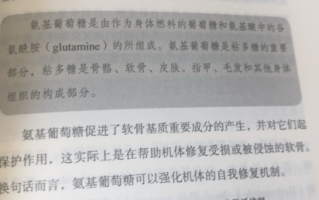 氨糖软骨素哪个牌子好？应该怎么选？